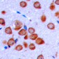 Anti-OLFML2B Antibody